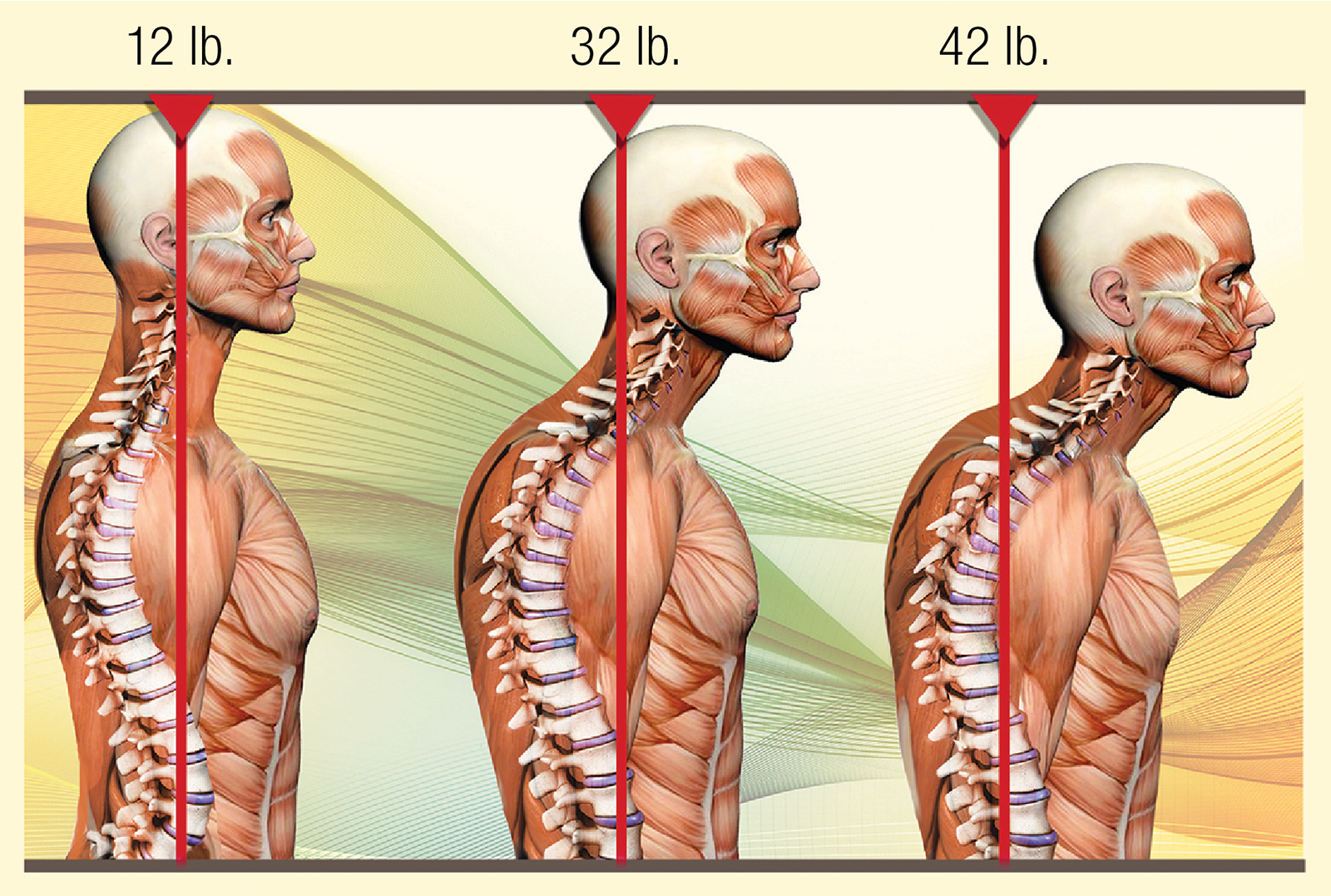 MA_15_Myoskeletal1_Main_1600 MA_15_Myoskeletal1_Main_1600