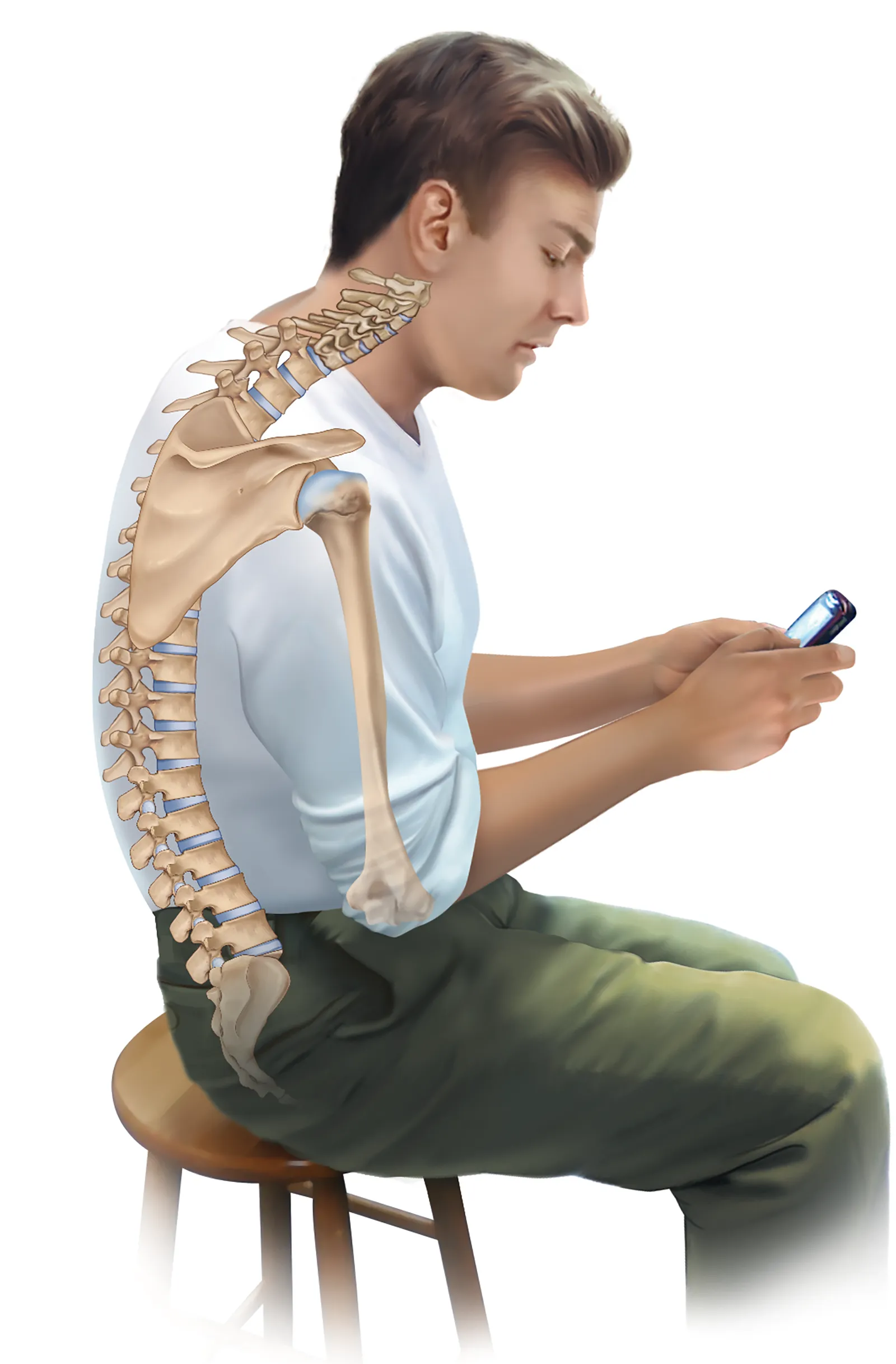 JA_16_ThoracicSpine2_1600