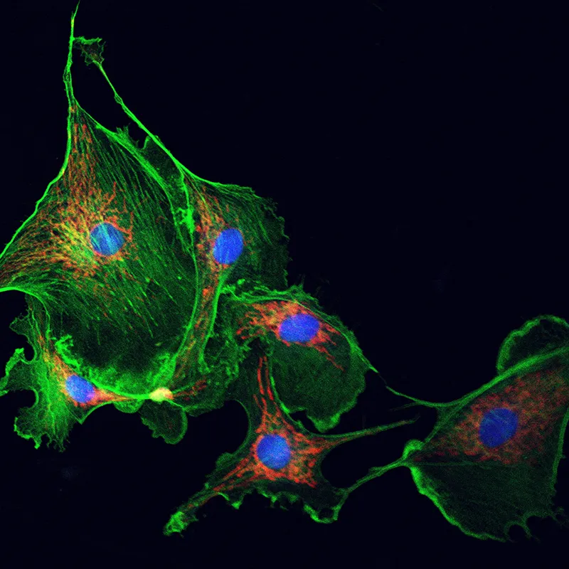 The myofibroblasts under a microscope in color.