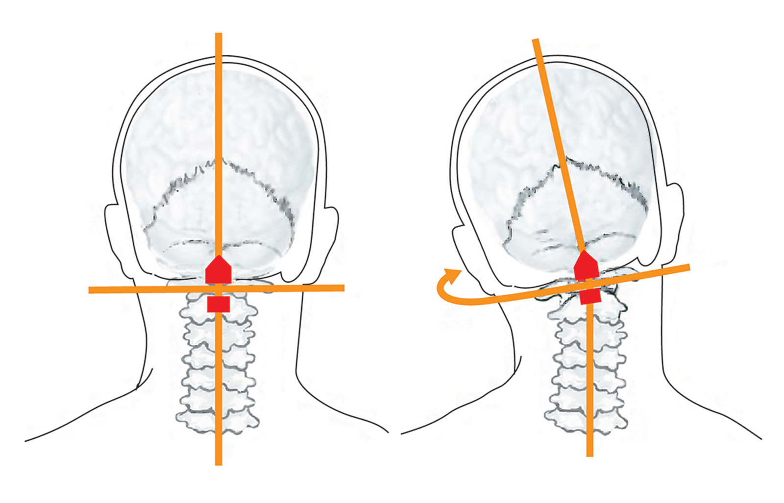 JF_15_Myoskeletal2_1600