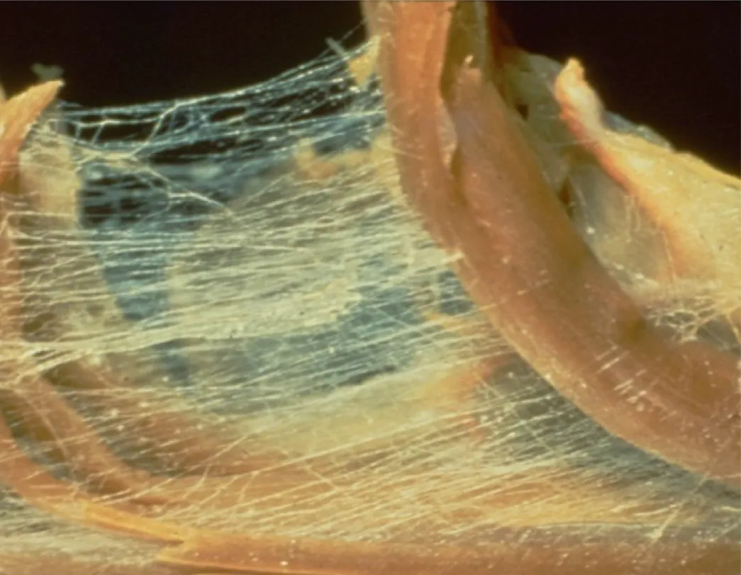 SO_16_LivingFascia_CottonCandy_Guimberteau_px1045 SO_16_LivingFascia_CottonCandy_Guimberteau_px1045