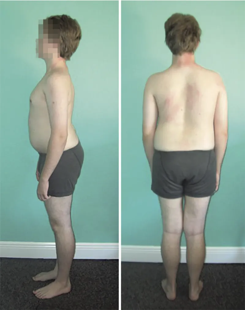 MJ_19_StructuralIntegration3_800 MJ_19_StructuralIntegration3_800