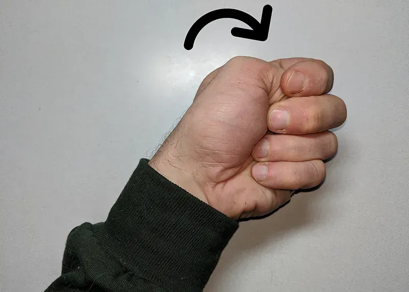 JF_21_ClinicalExplorations4 JF_21_ClinicalExplorations4