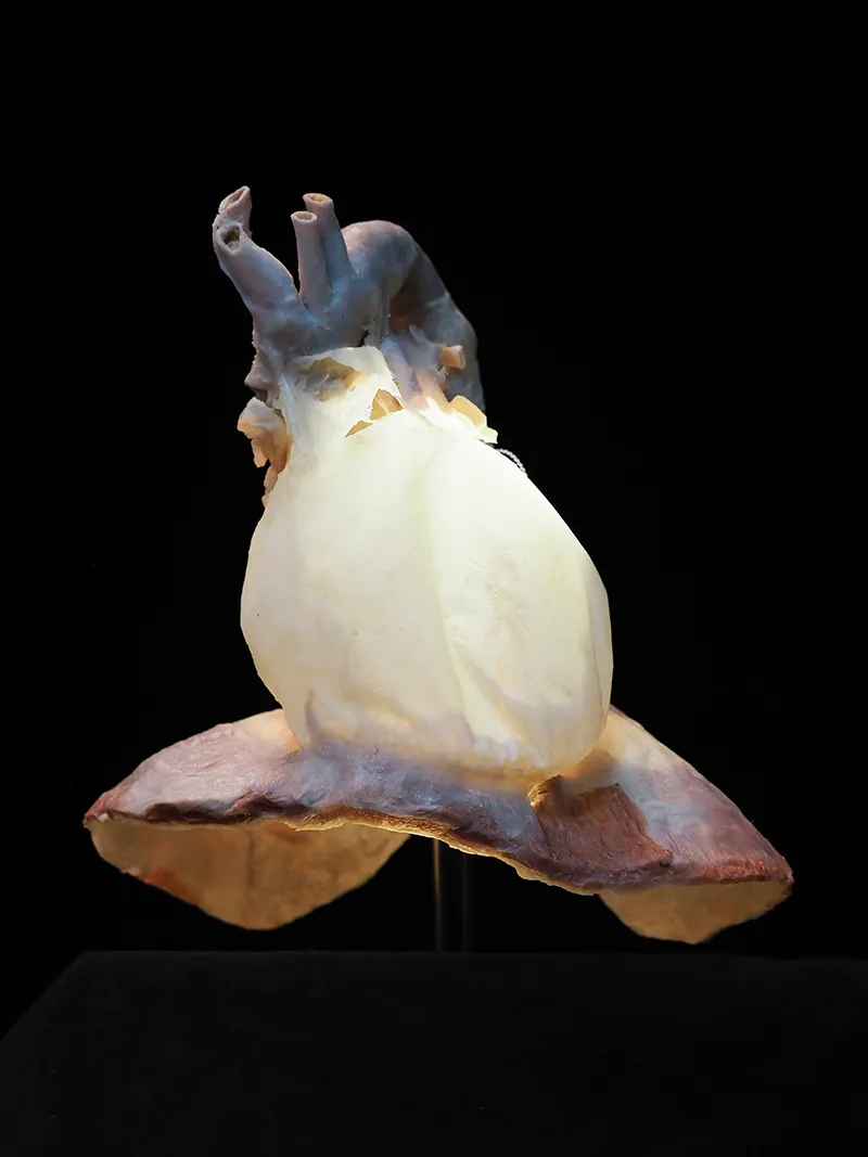 AUT_26_AnatomyTouch2_©FascialNetPlastinationProject_800