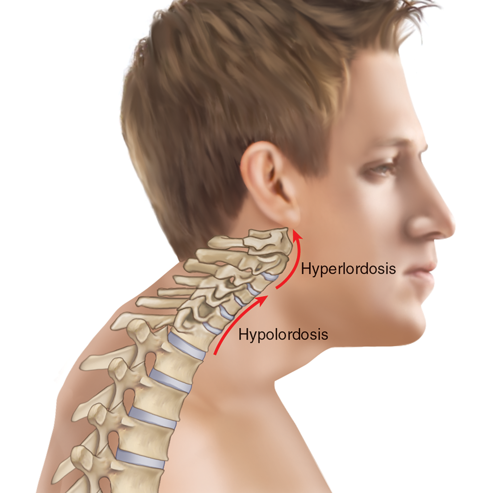 JA_16_ThoracicSpine4_1600