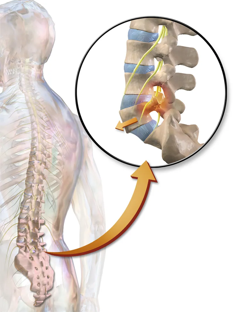 ND_18_Applied Biomechanics4
