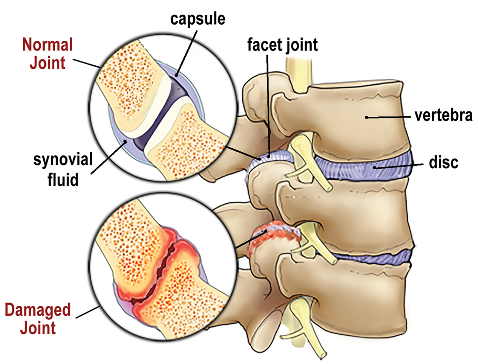 MA20_Myoskeletal Main