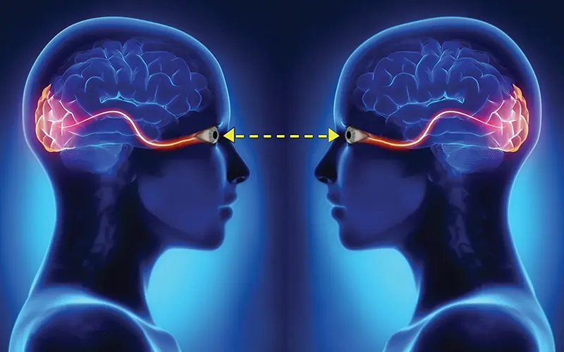 Myoskeletal_The_Eyes_Have_It1 Myoskeletal_The_Eyes_Have_It1