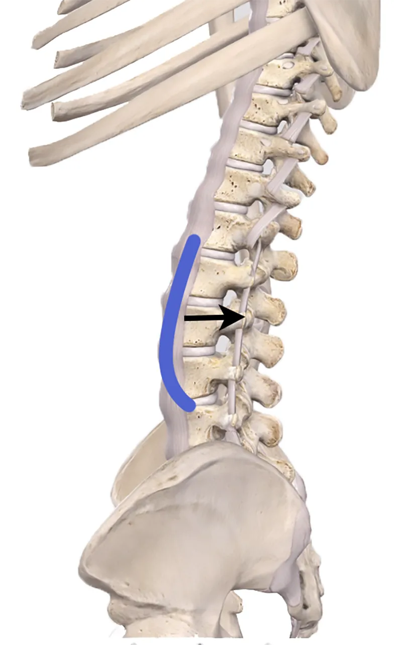 JF20_Lumbar Spine3 JF20_Lumbar Spine3