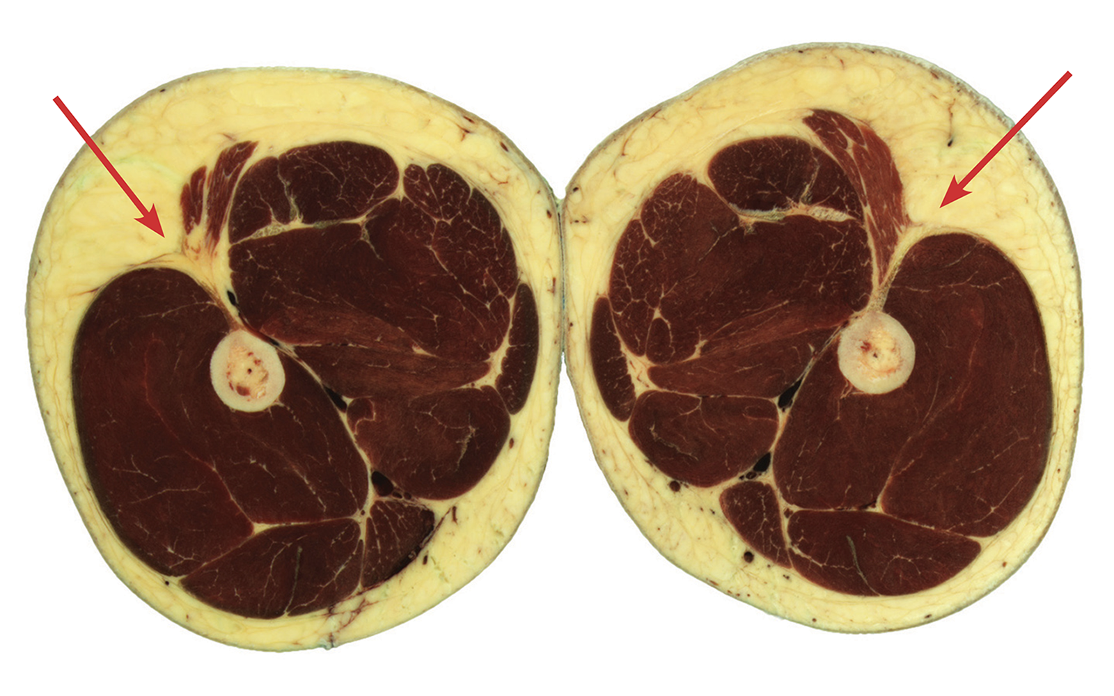 MJ_16_Myofascial3_1600 MJ_16_Myofascial3_1600