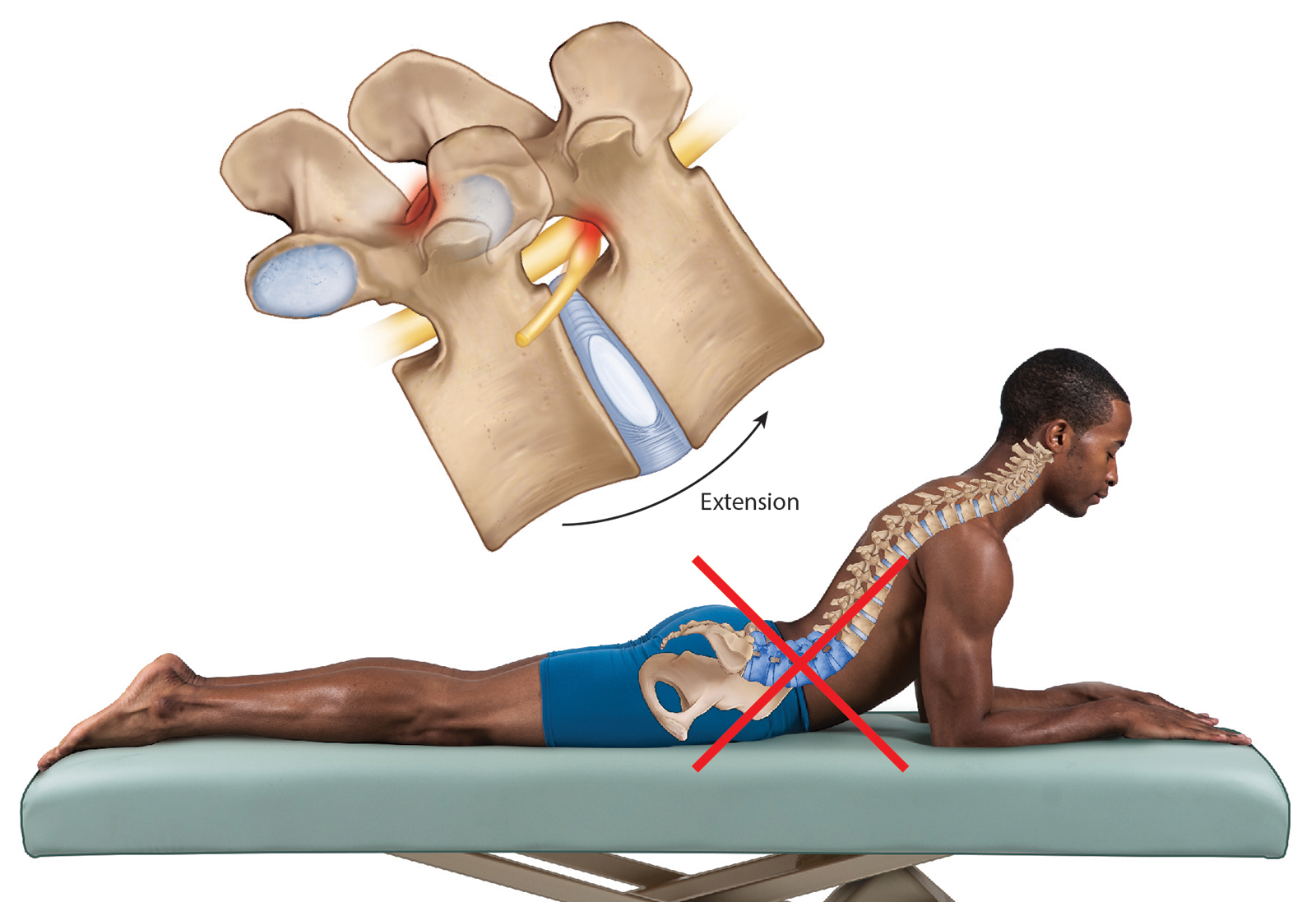 JA_16_ThoracicSpine6_1600