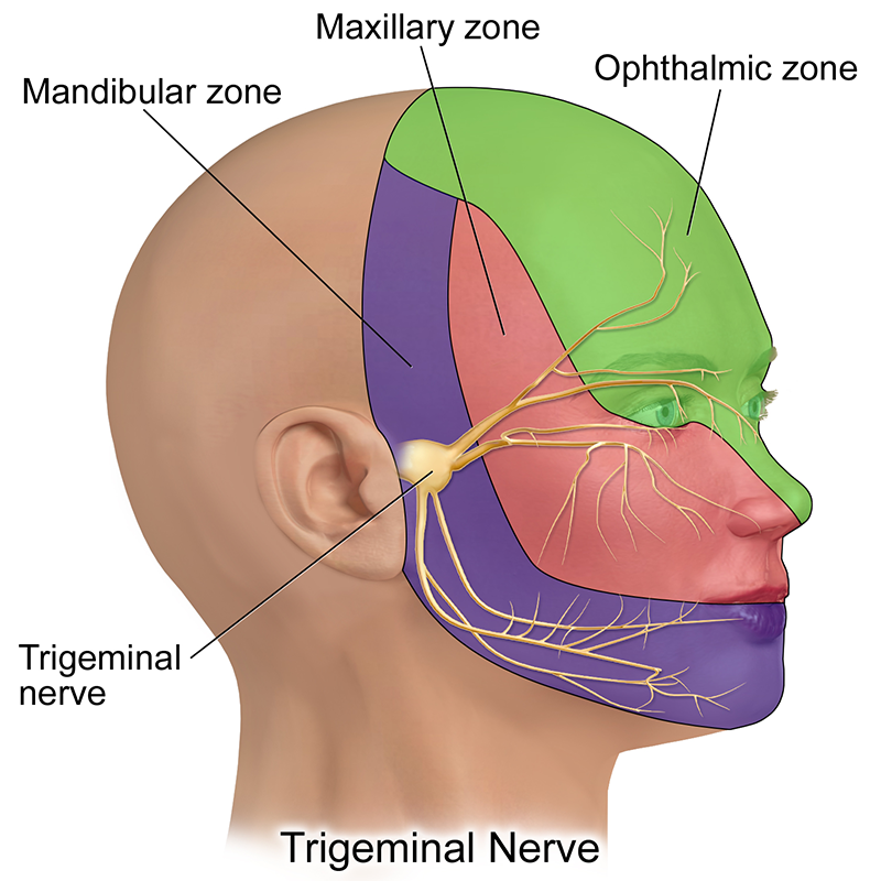 MA20_ Trigeminal Neuralgia MA20_ Trigeminal Neuralgia