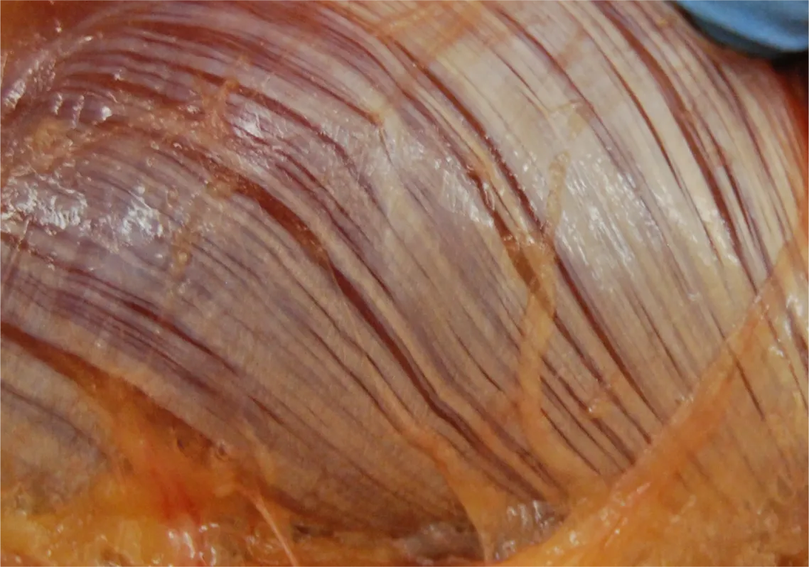 SO_16_LivingFascia_epimysium_Guimberteau_px1138 SO_16_LivingFascia_epimysium_Guimberteau_px1138