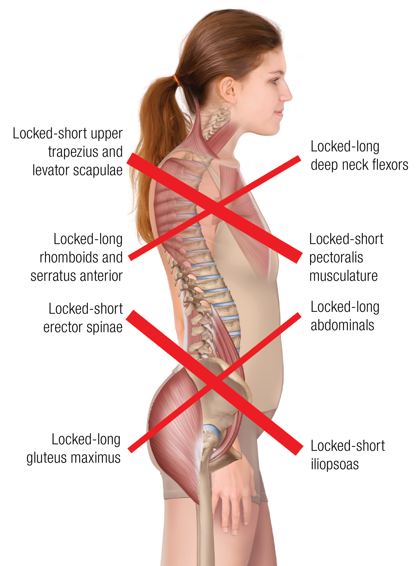 JA_16_ThoracicSpine3_1600
