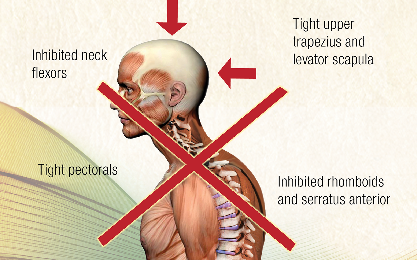 JF_15_Myoskeletal6_1600
