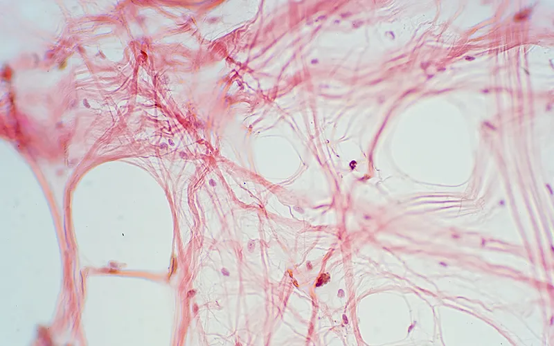 WIN_25_AnatomyForTouch3_GettyImages-1180318275_800This histological image of loose connective tissue shows many fibroblasts (rounded dark purple spots) among the web of collagen fibers they created (long pink web-thin lines).