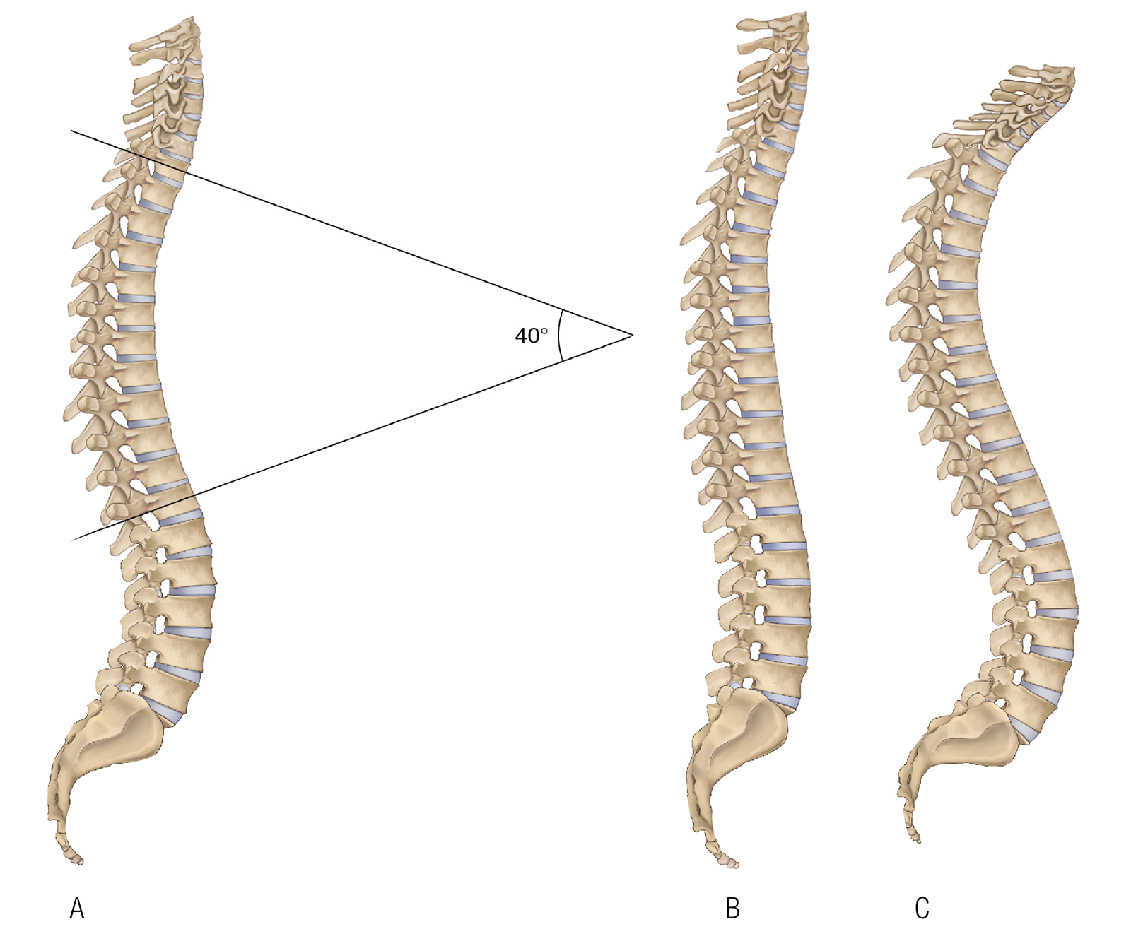 JA_16_ThoracicSpine1_ABC_1600
