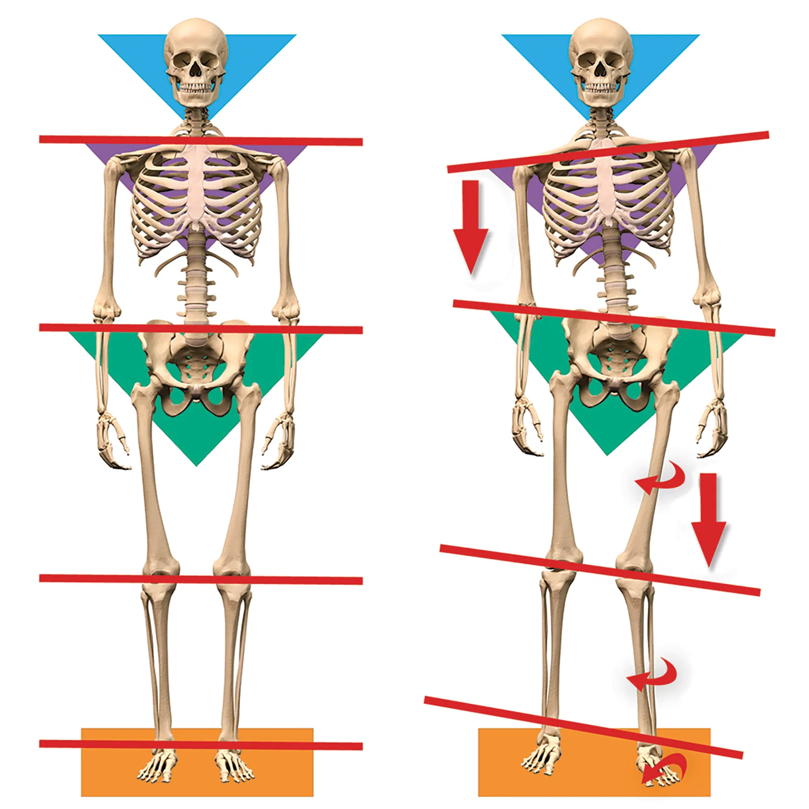 ND_14_Myoskeletal2_1600