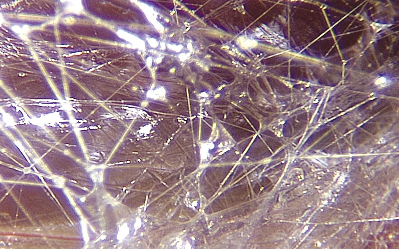 SO_16_LivingFascia4_Guimberteau_1600 SO_16_LivingFascia4_Guimberteau_1600