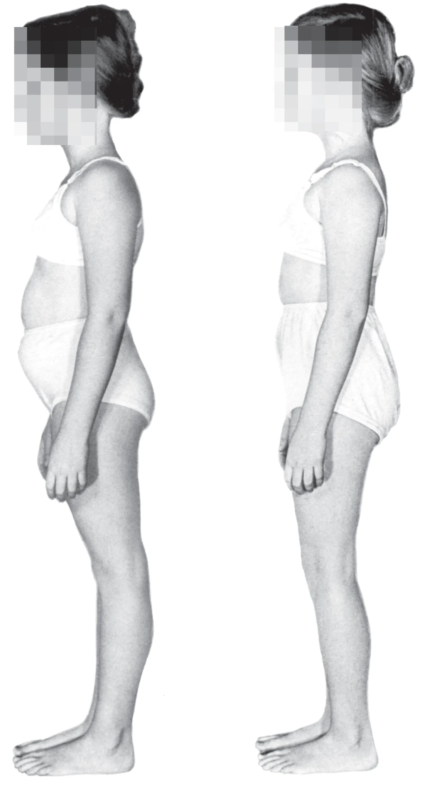 SO_16_UnderstandingFascia_MyStory_Posture