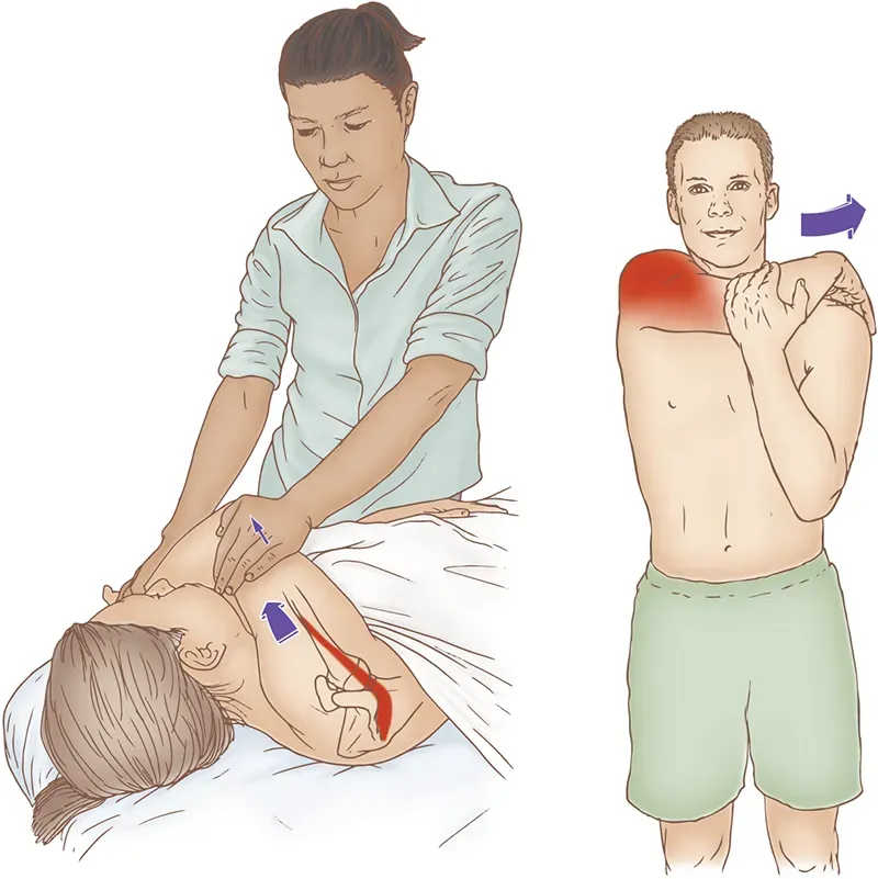 ND20_Combining Movement Therapies2