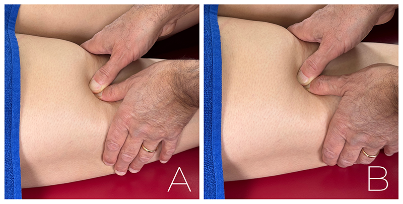 AUT_26_TissueTension9AB_800