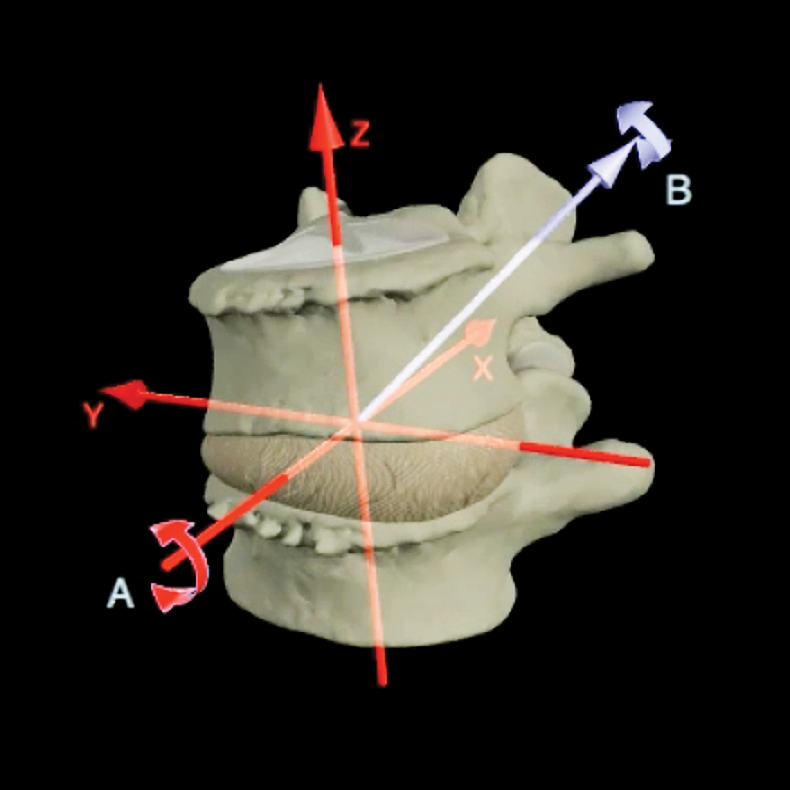 SO_15_Myofascial4_1600 SO_15_Myofascial4_1600