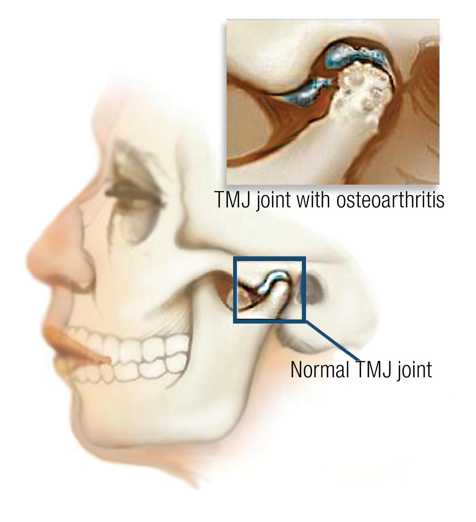 JF_15_Myoskeletal1_1600