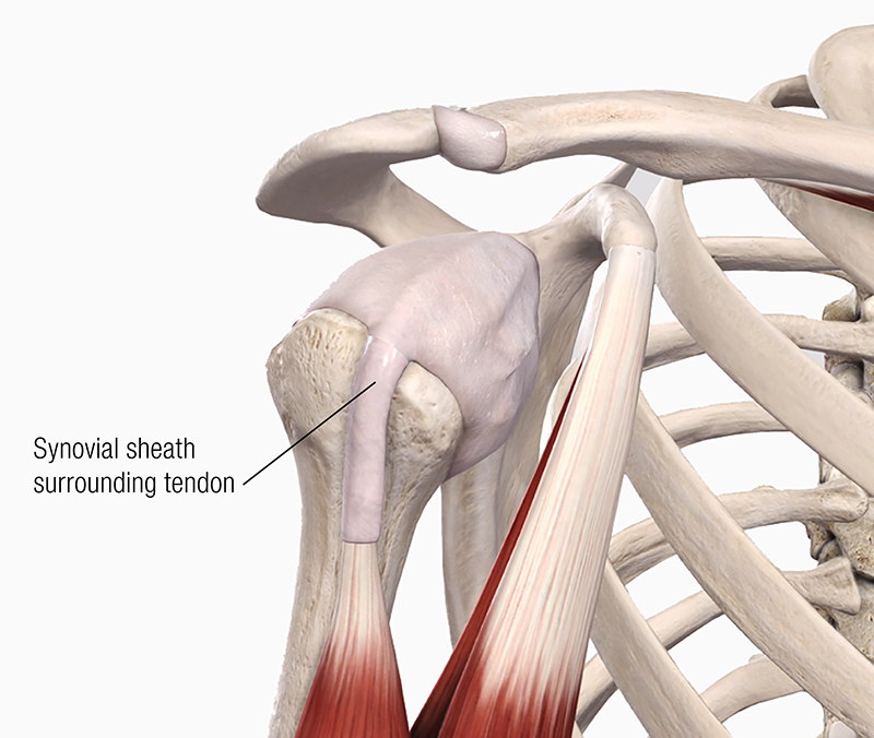 JA19_Bicipital Tendinopathy2 JA19_Bicipital Tendinopathy2