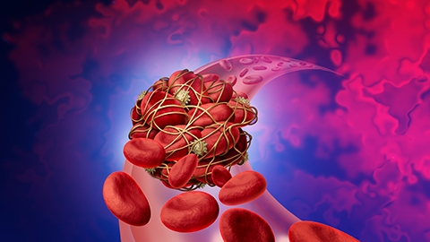 thrombosis medical illustration concept symbol as a group of human blood cells.