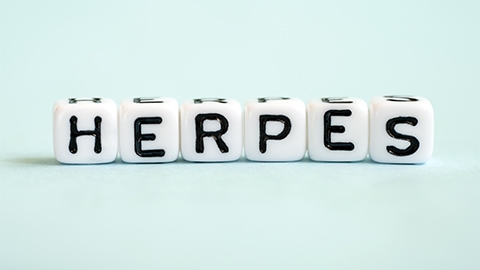 Image of block letters spelling herpes.