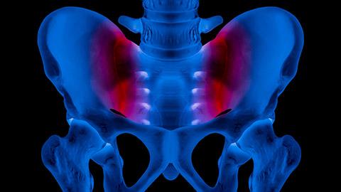3D animated image of the Sacroiliac Joint.
